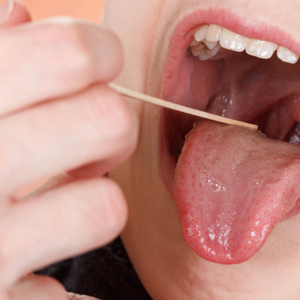 adenotomia usuniecie trzeciego migdalka