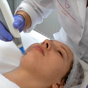 dermapen film - OT CO dermapen film - OT CO