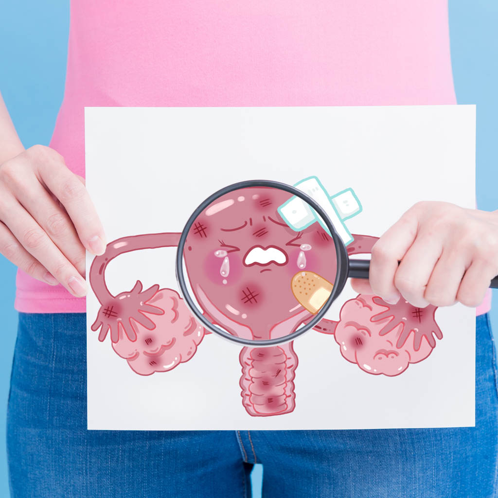 elektrokonizacja szyjki macicy