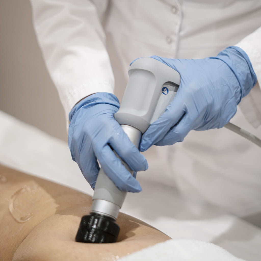 fala uderzeniowa na cellulit - OT CO