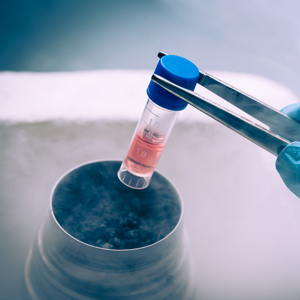 komorki macierzyste anti aging