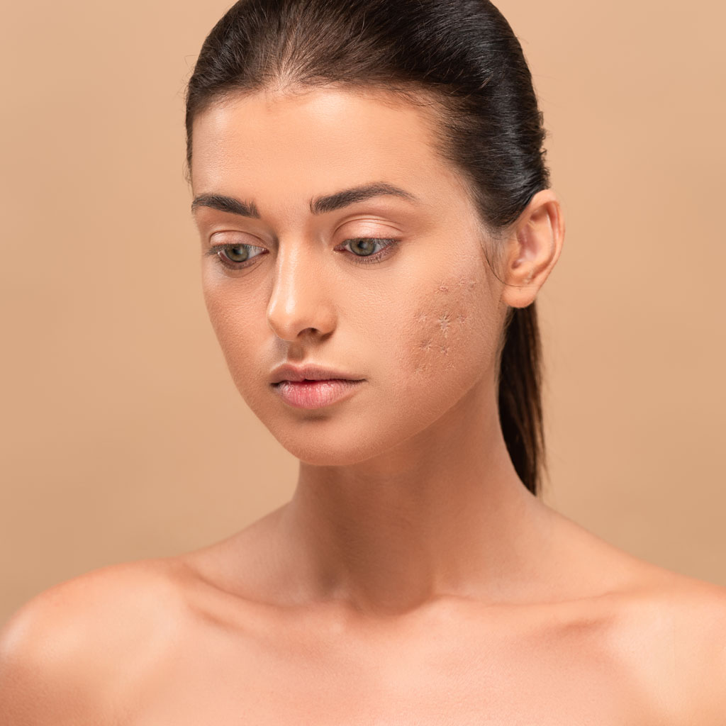 korekta blizn nano tluszczem warszawa