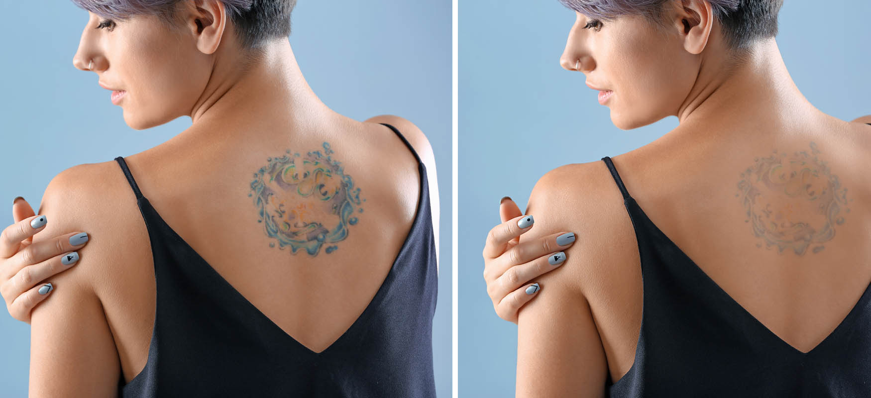 laser pikosekundowy efekty laser pikosekundowy efekty