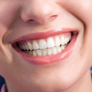 Leczenie uśmiechu dziąsłowego botoksem