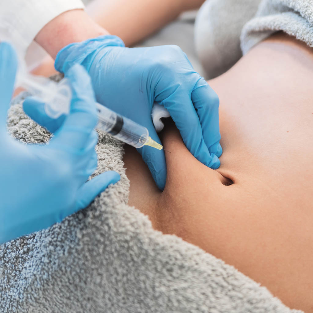 lipoliza iniekcyjna brzucha - OT CO