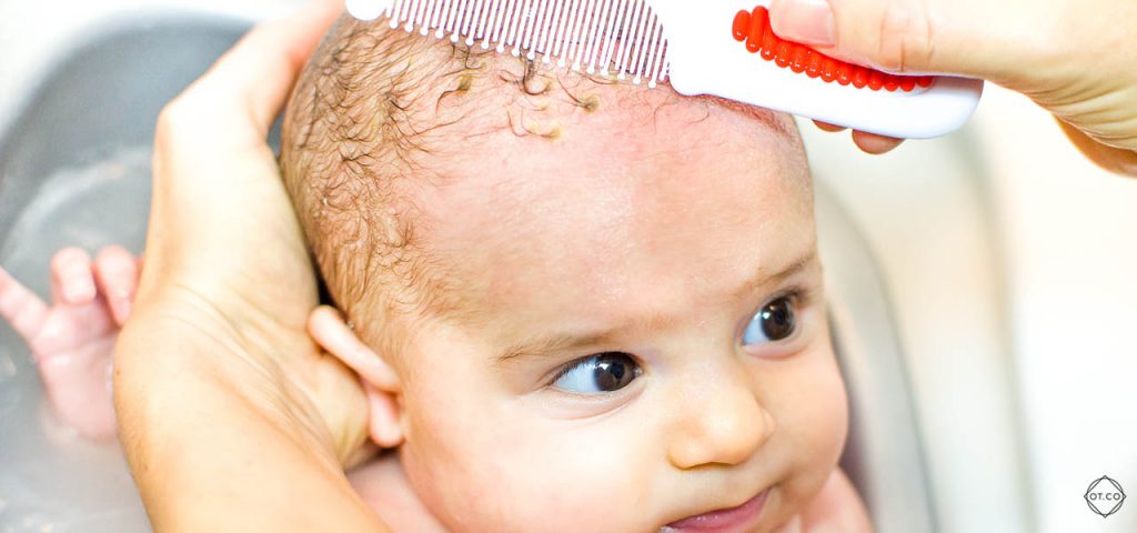 lojotokowe zapalenie skory u niemowlecia lojotokowe zapalenie skory u niemowlecia