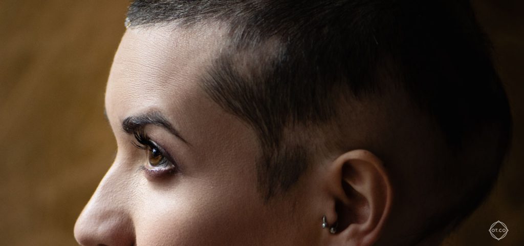 lysienie plackowate lysienie plackowate