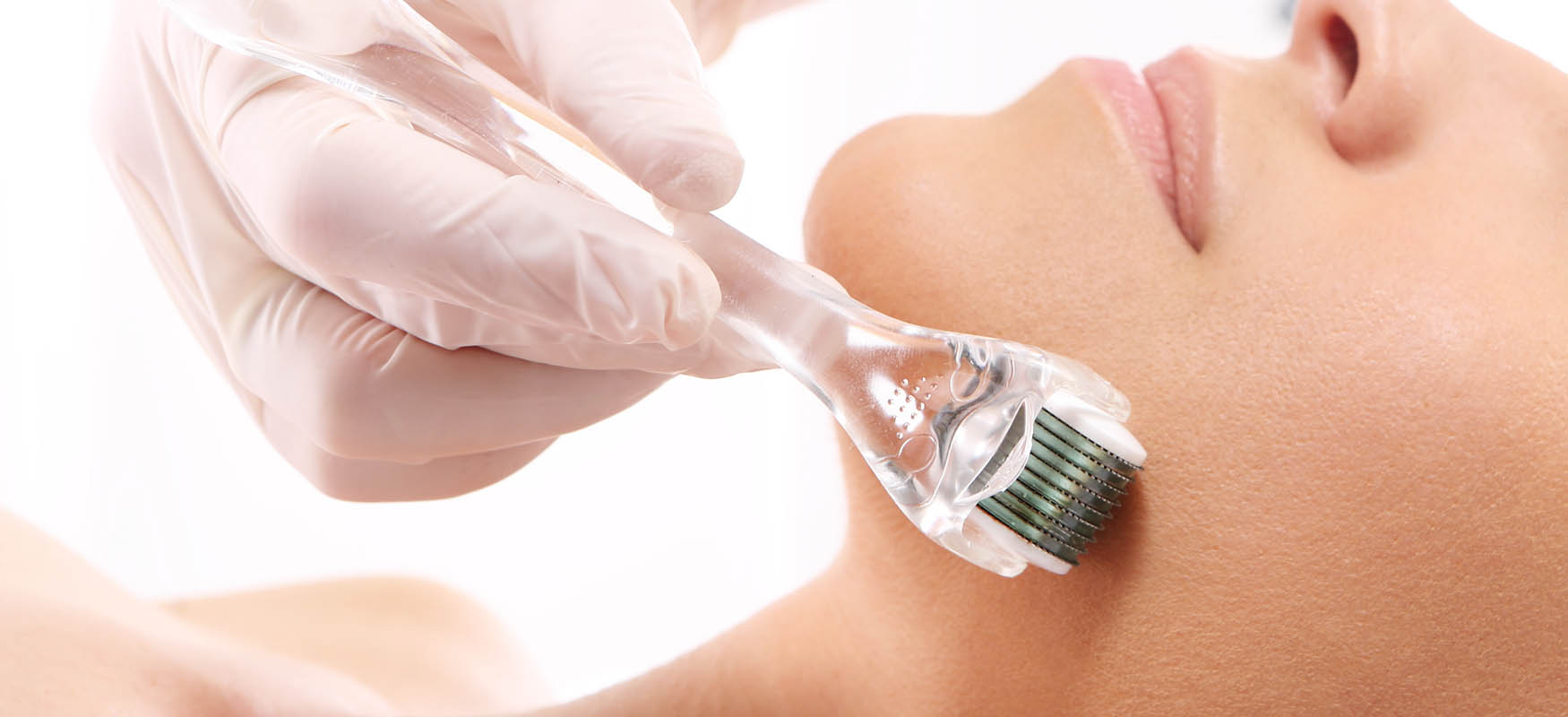 mezoterapia mikroiglowa roller mezoterapia mikroiglowa roller