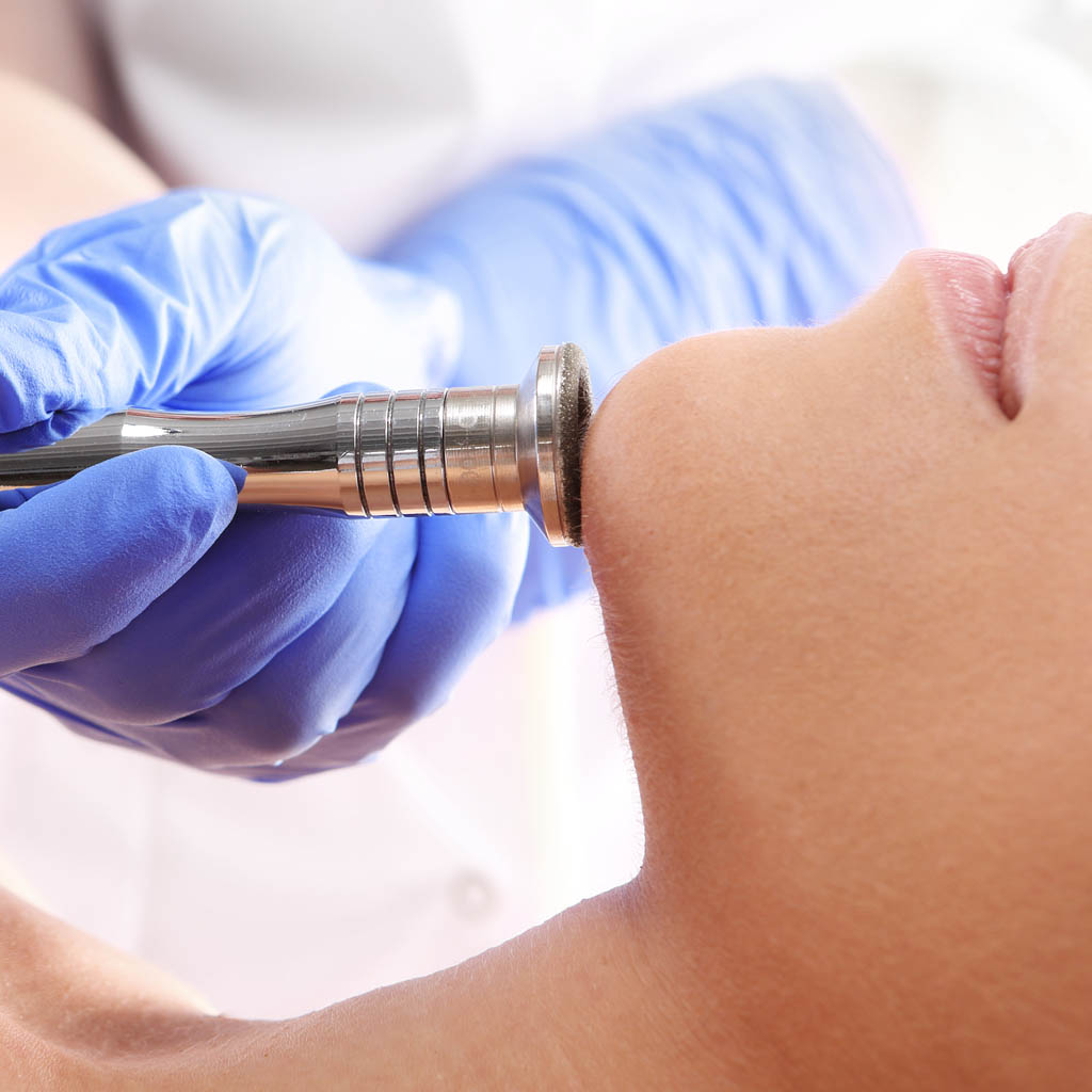 mikrodermabrazja korundowa - OT CO