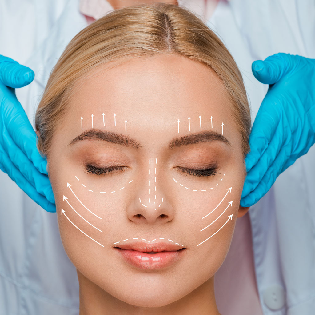 nici aptos warszawa lifting