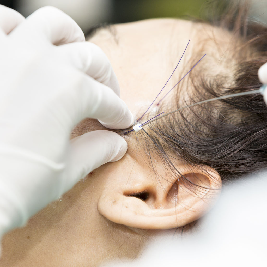 nici liftingujace barb 4d warszawa