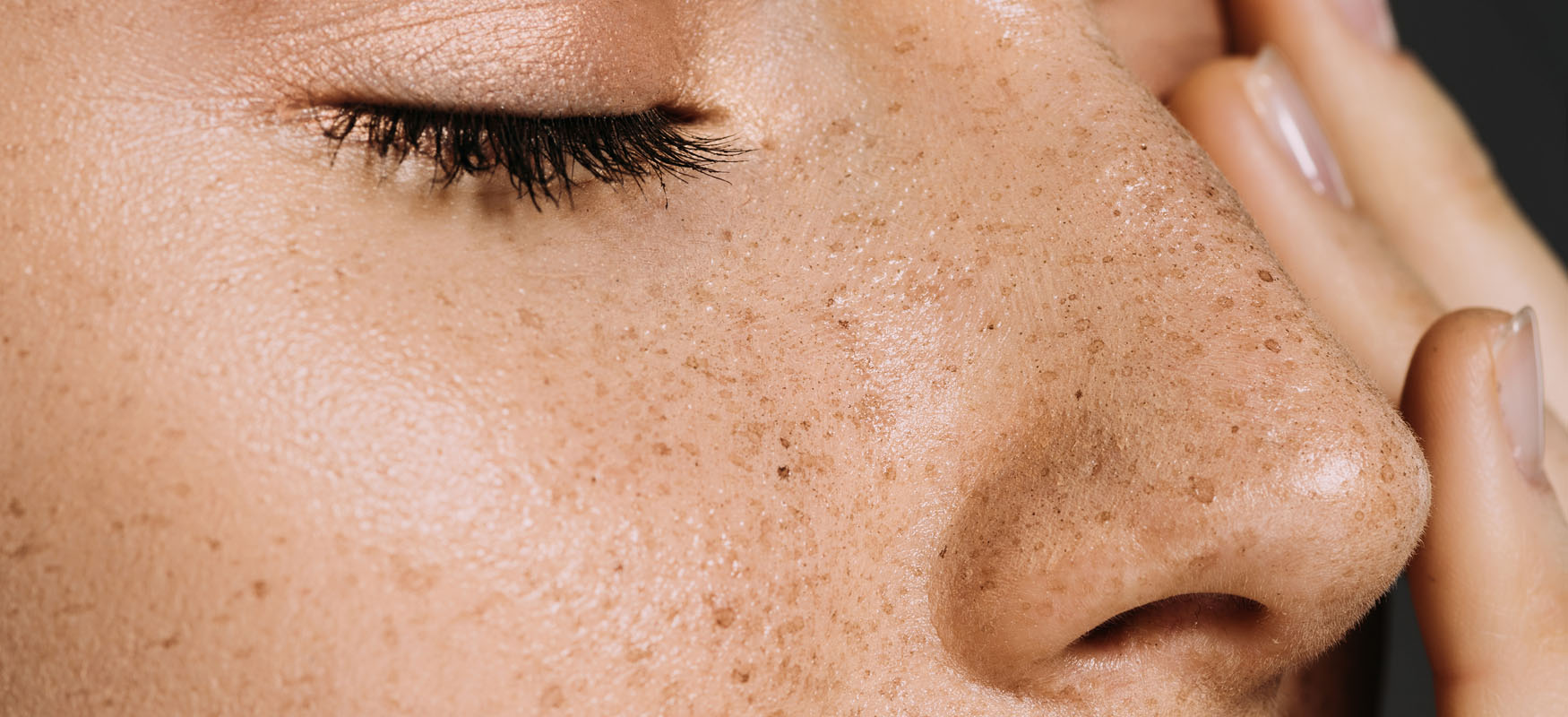 Przebarwienia na twarzy - pakiet zabiegów