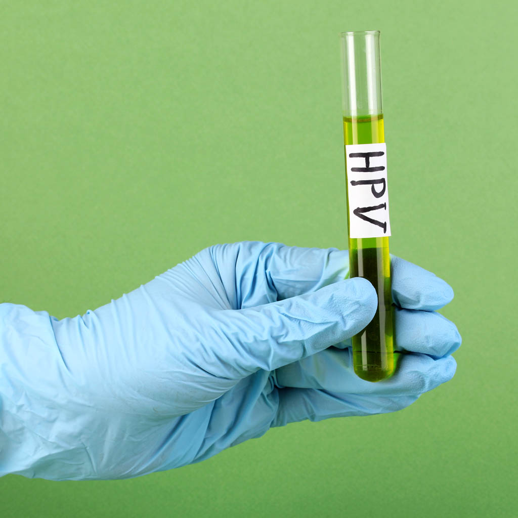 test hpv|wskazania