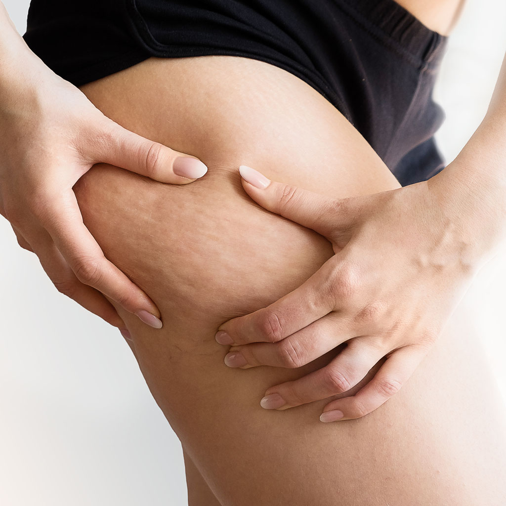 zabieg antycellulitowy bandazami diego dalla palma