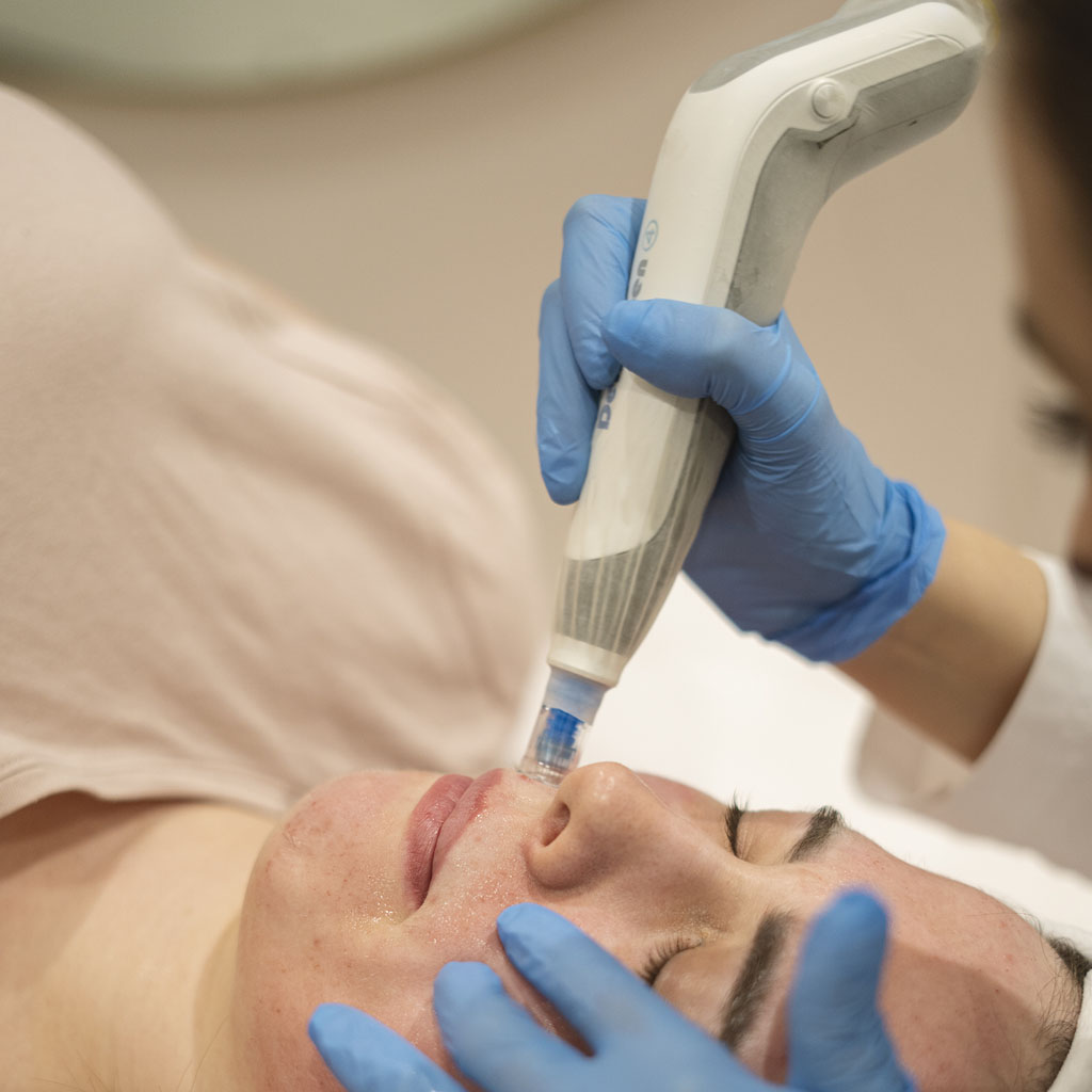 zabieg dermapen 4 0|dermapen warszawa|dermapen film|maxresdefault