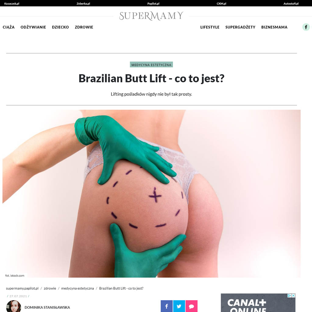supermamy brazilian butt lift - OT CO
